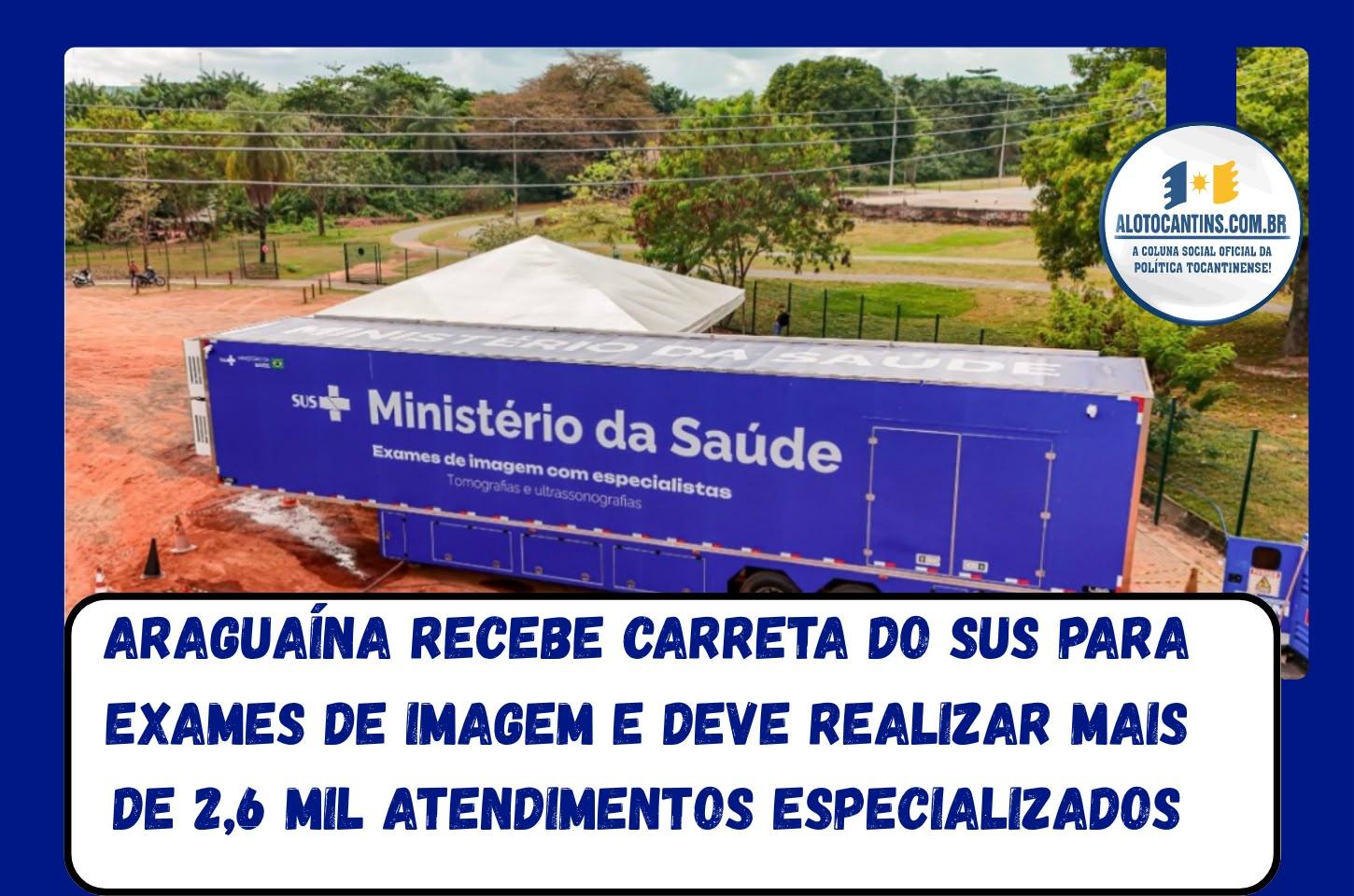 Araguaína recebe carreta do SUS para exames de imagem e deve realizar mais de 2,6 mil atendimentos especializados